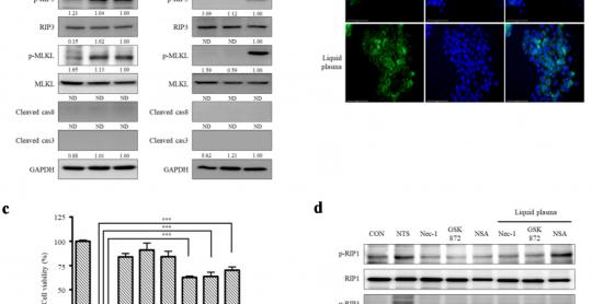 Liquid Plasma Induces Necroptosis Without Inflammatory Responses in Head and Neck Cancer Cells